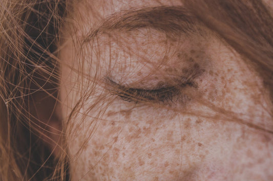 What to Do with Under the Skin Pimples